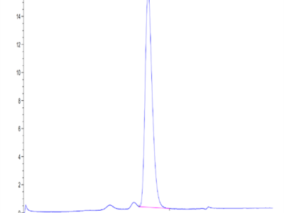 Human CD3D/CD3 delta Protein (CDD-HM101)