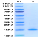 Human CD3D/CD3 delta Protein (CDD-HM101)