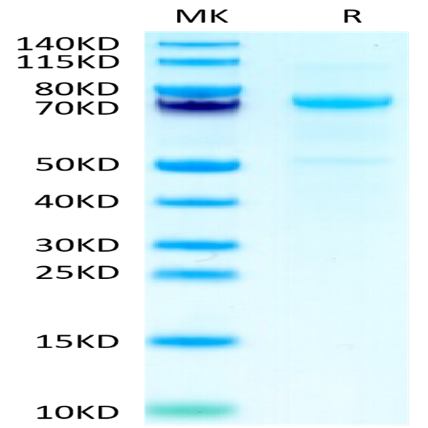 Cynomolgus CDH3/Cadherin 3 Protein (CDH-CM103)