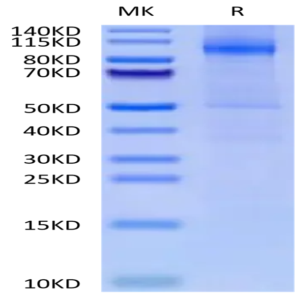 Cynomolgus CDH17/Cadherin 17 Protein (CDH-CM117)