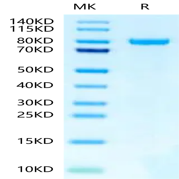 Human N Cadherin Protein (CDH-HM10N)
