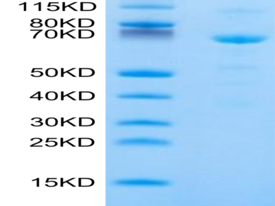 Human CDH11/Cadherin 11 Protein (CDH-HM111)