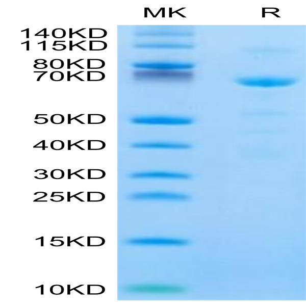 Human CDH11/Cadherin 11 Protein (CDH-HM111) Human CDH11/Cadherin 11 Protein (CDH-HM111)