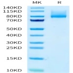 Human CDH6/Cadherin-6 Protein (CDH-HM116)