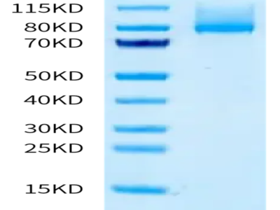 Human CDH6/Cadherin-6 Protein (CDH-HM116)