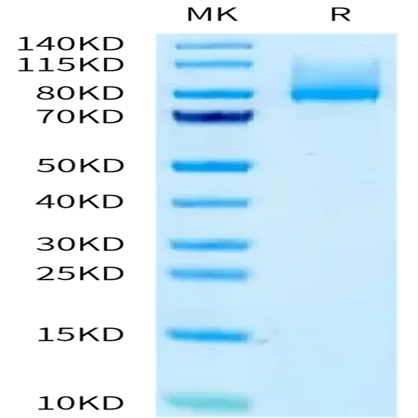 Human CDH6/Cadherin-6 Protein (CDH-HM116) Human CDH6/Cadherin-6 Protein (CDH-HM116)