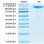 Human CDH17/Cadherin 17 Protein (CDH-HM117)