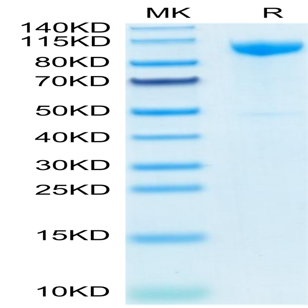Human CDH17/Cadherin 17 Protein (CDH-HM117)