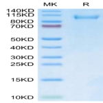 FITC-Labeled Human CDH17/Cadherin 17 Protein (CDH-HM117F)