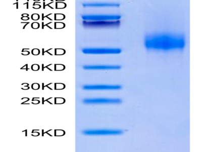 Human CDH17/Cadherin 17 Domain 5-7 Protein (CDH-HM1D4)