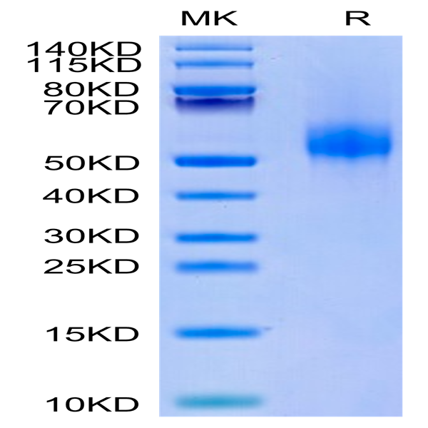 Human CDH17/Cadherin 17 Domain 5-7 Protein (CDH-HM1D4) Human CDH17/Cadherin 17 Domain 5-7 Protein (CDH-HM1D4)