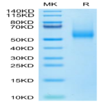 Biotinylated Human CDH17/Cadherin 17 Domain 5-7 Protein (Primary Amine Labeling) (CDH-HM1D4B)
