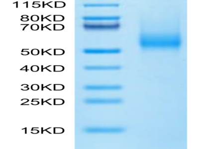 Biotinylated Human CDH17/Cadherin 17 Domain 5-7 Protein (Primary Amine Labeling) (CDH-HM1D4B)
