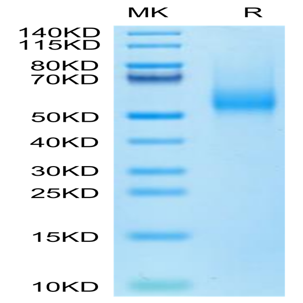 Biotinylated Human CDH17/Cadherin 17 Domain 5-7 Protein (Primary Amine Labeling) (CDH-HM1D4B) Biotinylated Human CDH17/Cadherin 17 Domain 5-7 Protein (Primary Amine Labeling) (CDH-HM1D4B)