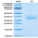 Human CDH17/Cadherin 17 Domain 1&2 Protein (CDH-HM1D5)