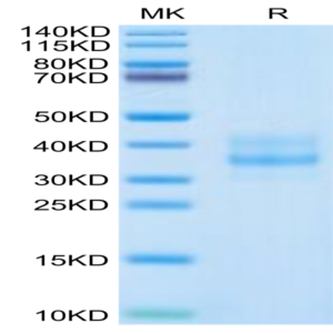 Human CDH17/Cadherin 17 Domain 1&2 Protein (CDH-HM1D5)