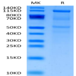 Human CDH6/Cadherin-6 Protein (CDH-HM206)