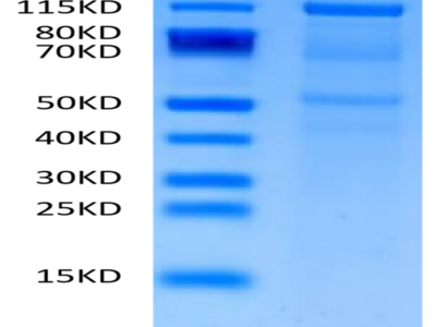 Human CDH6/Cadherin-6 Protein (CDH-HM206)