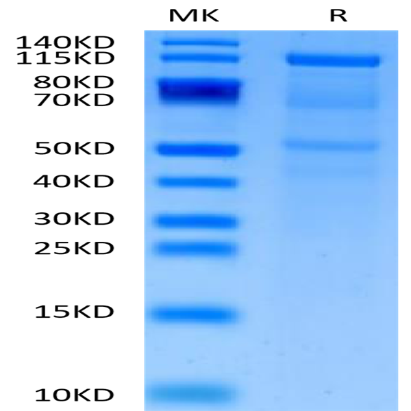 Human CDH6/Cadherin-6 Protein (CDH-HM206) Human CDH6/Cadherin-6 Protein (CDH-HM206)