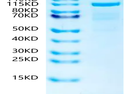 Human N Cadherin Protein (CDH-HM20N)