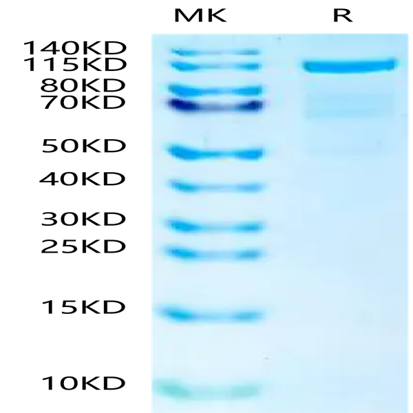 Human N Cadherin Protein (CDH-HM20N) Human N Cadherin Protein (CDH-HM20N)