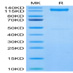 Human CDH17/Cadherin 17 Protein (CDH-HM217)