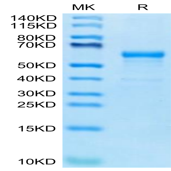 Human CDH17/Cadherin 17 Domain 6-7 Protein (CDH-HM2D2)