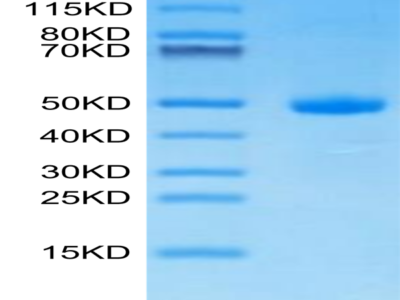 Human CDH17/Cadherin 17 Domain 7 Protein (CDH-HM2D3)