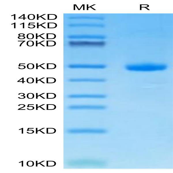 Human CDH17/Cadherin 17 Domain 7 Protein (CDH-HM2D3) Human CDH17/Cadherin 17 Domain 7 Protein (CDH-HM2D3)