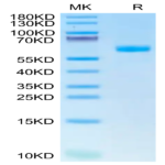 Human CDH17/Cadherin 17 Domain 6-7 Protein (CDH-HM3D2)
