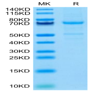 Mouse CDH3/Cadherin 3 Protein (CDH-MM103)