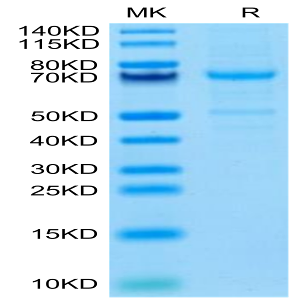 Mouse CDH3/Cadherin 3 Protein (CDH-MM103) Mouse CDH3/Cadherin 3 Protein (CDH-MM103)