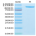 Mouse CDH17/Cadherin 17 Protein (CDH-MM117)