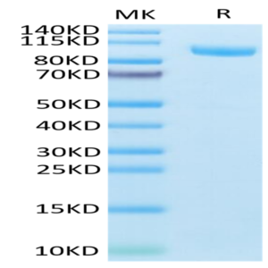 Mouse CDH17/Cadherin 17 Protein (CDH-MM117)