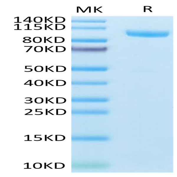 Mouse CDH17/Cadherin 17 Protein (CDH-MM117)