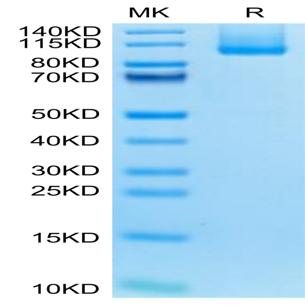 Biotinylated Mouse CDH17/Cadherin 17 Protein (Primary Amine Labeling) (CDH-MM117B)