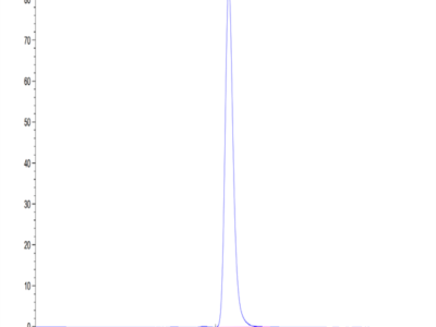 Human CHODL Protein (CDL-HM201)