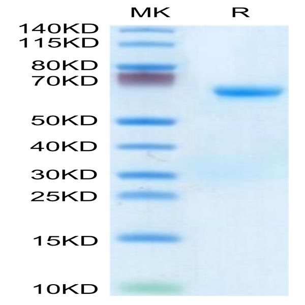 Human CHODL Protein (CDL-HM201)
