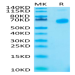 Human CD27 Ligand/CD70 Trimer Protein (CDL-HM427)