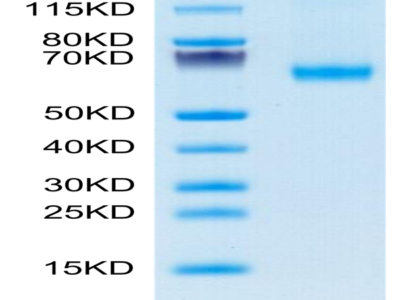 FITC-Labeled Human CD27 Ligand/CD70 Trimer Protein (CDL-HM427F)