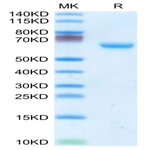 Mouse CHODL Protein (CDL-MM201)