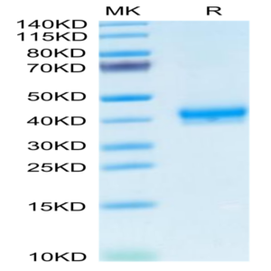 Human CADM3 Protein (CDM-HM103)