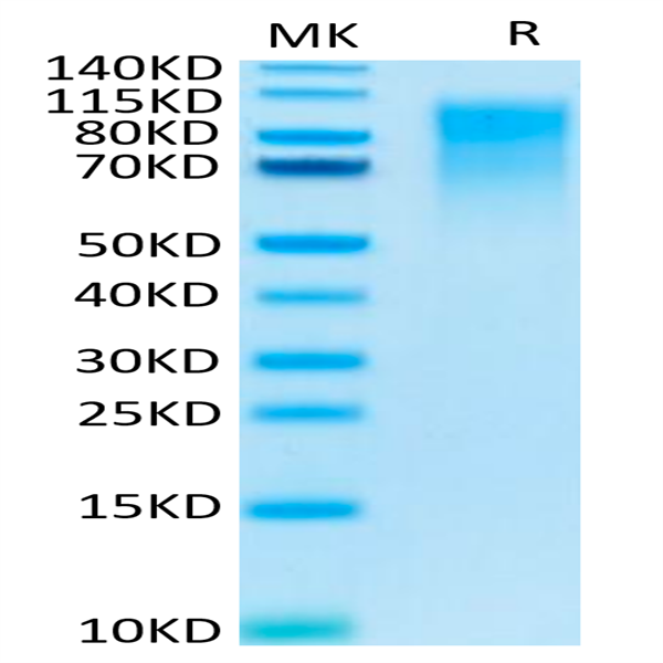 Human CEACAM-1/CD66a Protein (CEA-HM201)