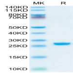 Rhesus macaque Complement Factor D/CFD Protein (CFD-CM101)
