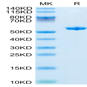 Human Complement Factor D/CFD Protein (CFD-HM201)