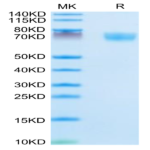 Mouse Complement Factor D/CFD Protein (CFD-MM201)