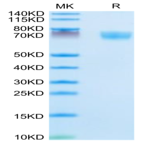 Mouse Complement Factor D/CFD Protein (CFD-MM201)