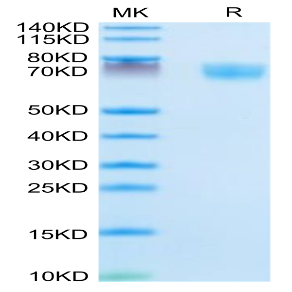 Mouse Complement Factor D/CFD Protein (CFD-MM201)