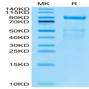 Human Complement factor I Protein (CFI-HM101)