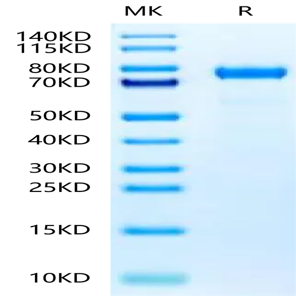 Rat Coagulation Factor II Protein (CFR-RM102)